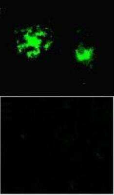 Immunohistochemistry: beta Amyloid [Pyro Glu11] Antibody [NBP1-44070]